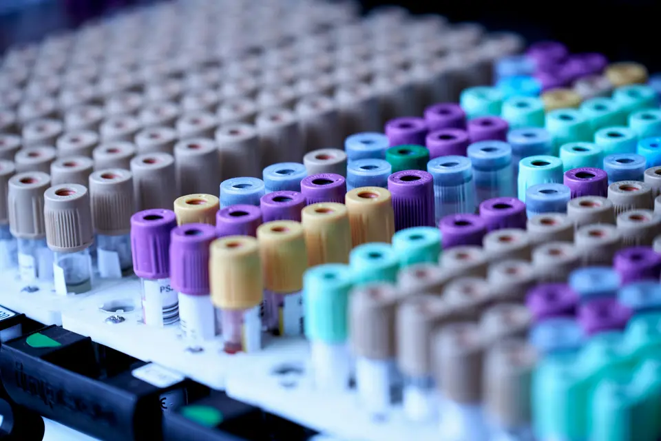Rows of purple, teal and beige-capped sample tubes in a rack